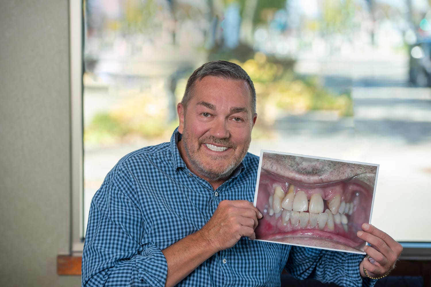 Dental implants in Hopkins