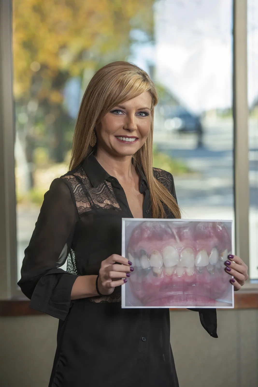 Cosmetic dentistry at Gendler Dental Center in Hopkins, MN.