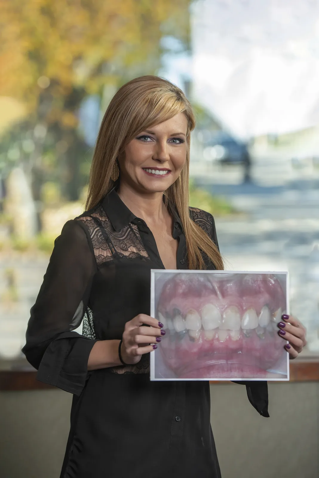 Dental veneers being crafted
