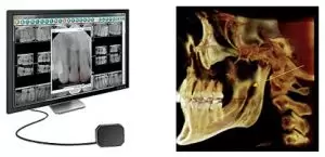 Advance dental technology provides precise treatment.