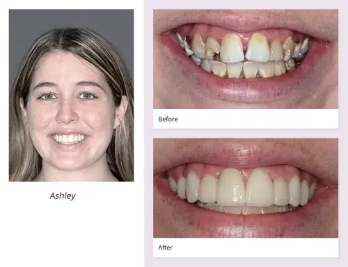 client-Ashley-before-after