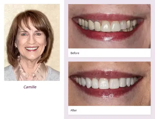 client-Camille-before-after