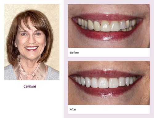 client-Camille-before-after