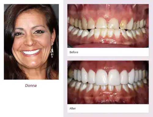 client-Donna-before-after