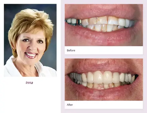 client-Inna-before-after