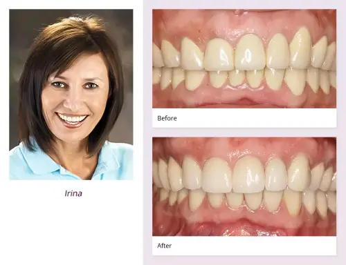 client-Irina-before-after
