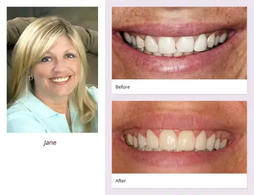 client-Jane-before-after
