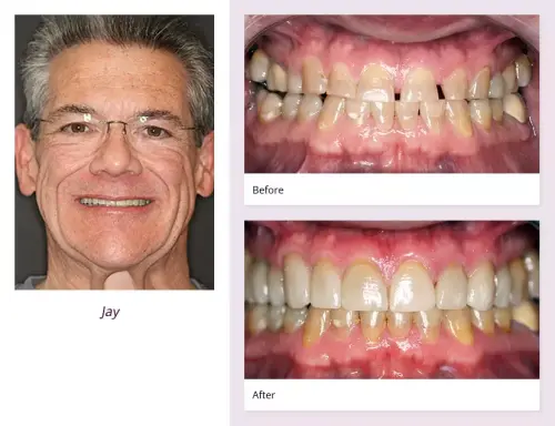 client-Jay-before-after