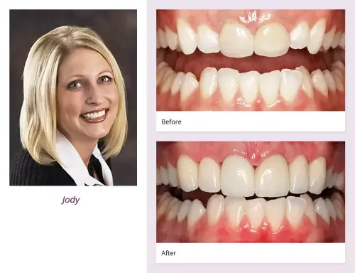 client-Jody-before-after