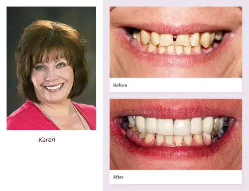 client-Karen-before-after