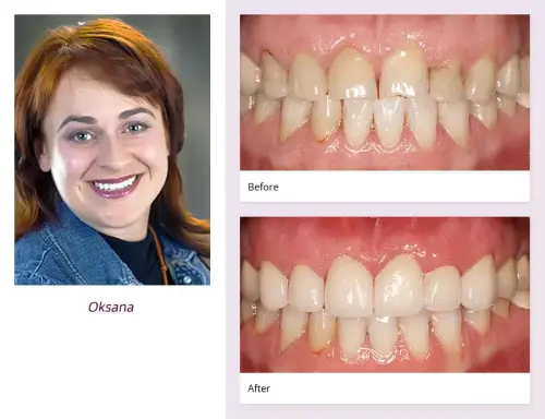client-Oksana-before-after