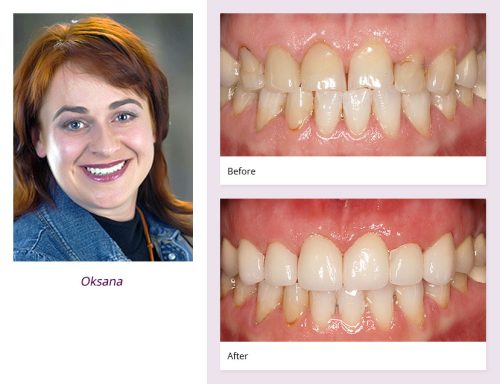 client-Oksana-before-after