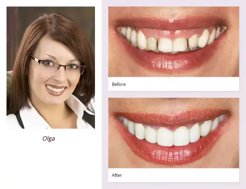 client-Olga-before-after