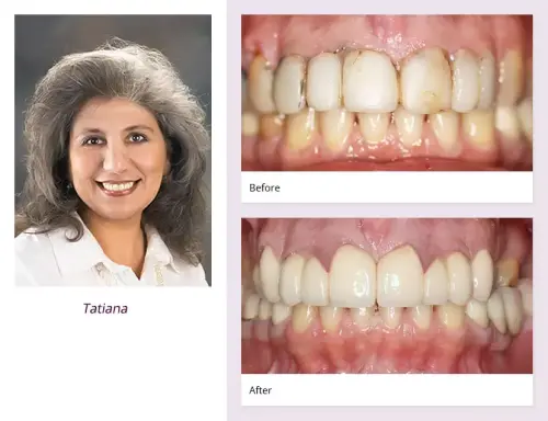 client-Tatiana-before-after