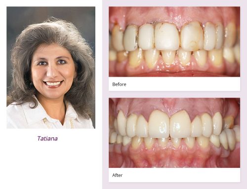 client-Tatiana-before-after