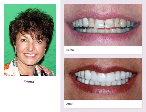 client-Emma-before-after